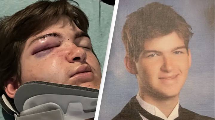 Family of boy who was brutally injured due to $20 bet suing teens involved for $6 million
