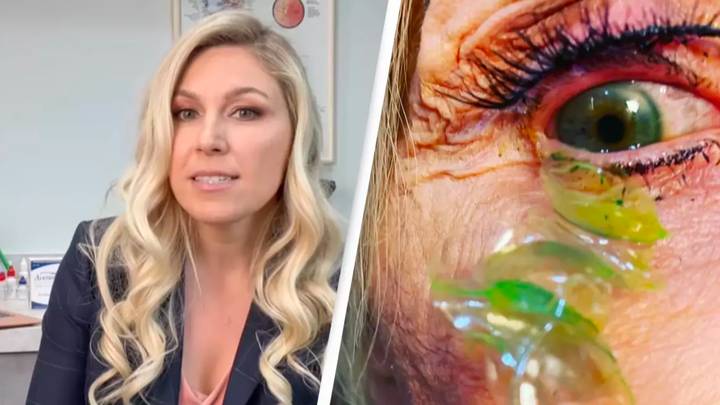 Doctor who removed 23 contact lenses from patient's eye has 'never seen anything like it'