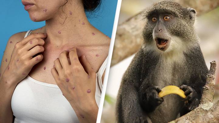 The WHO has had to step in to tell people not to attack monkeys over monkeypox