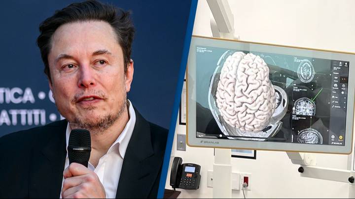 Elon Musk says first Neuralink brain chip has been implanted in a human