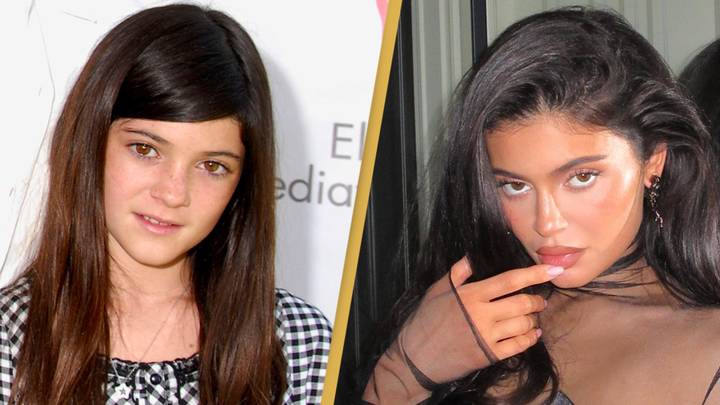 Kylie Jenner insists she hasn't had 'much' plastic surgery done to her face