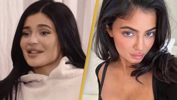 Kylie Jenner says she doesn't want her children to copy what she's done with cosmetic surgery