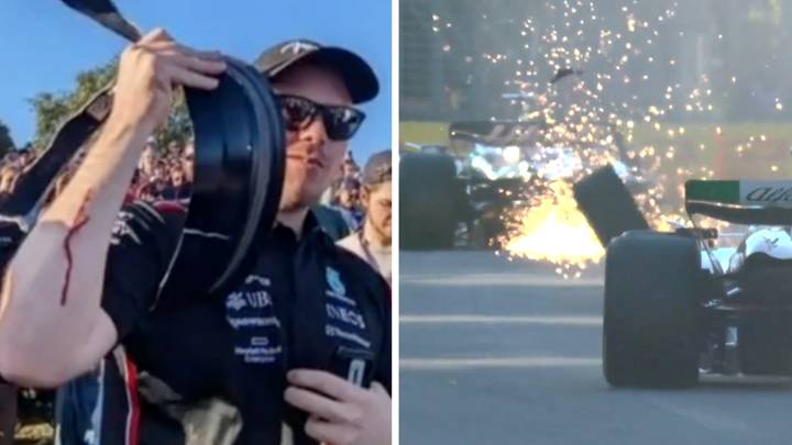 Spectator left bloodied after being hit by flying debris during Australian Grand Prix