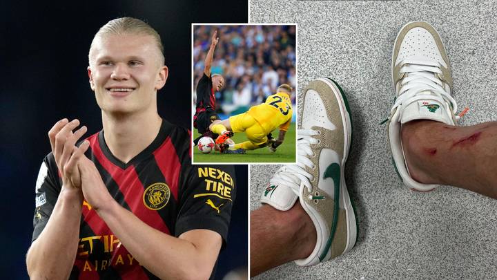 Erling Haaland shows off injuries from Brighton game, he was in the wars