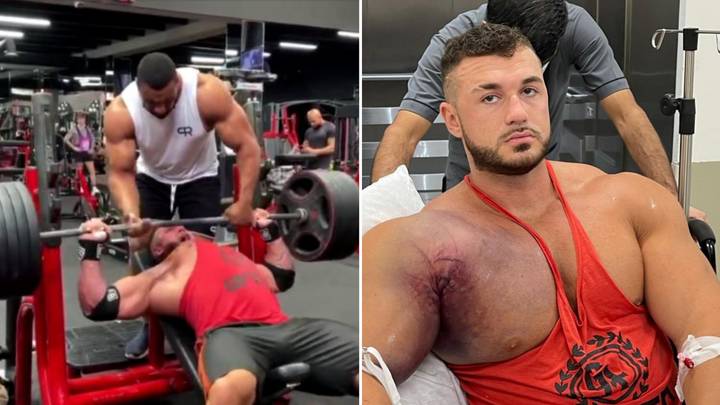 Horrific Moment Bodybuilder Tears His Pectoral From The Bone During Bench Press