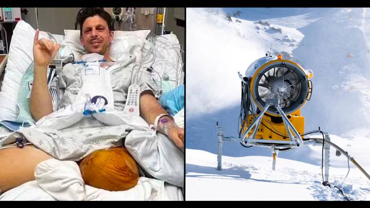 Brave dad loses legs after trying to save daughters from snow blower during ski lesson