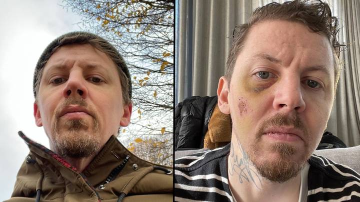 Professor Green nearly died after smashing his head onto steel and concrete during seizure