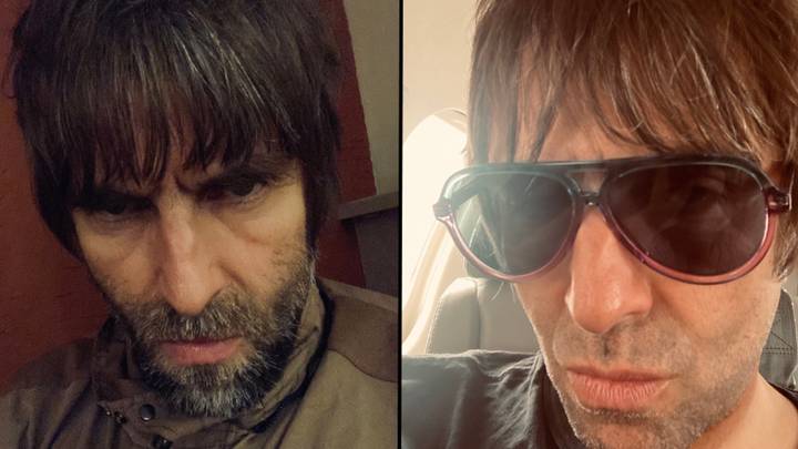 Liam Gallagher gives health update after getting ‘drugged up’ for surgery