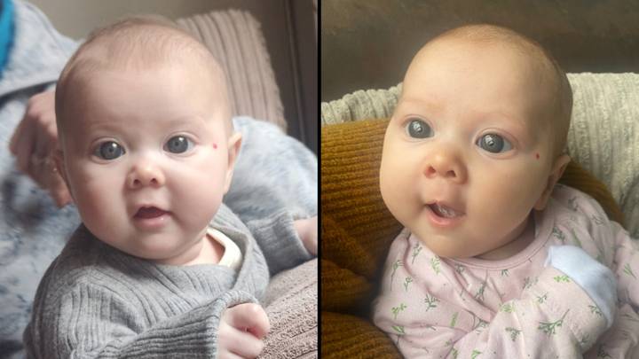 Baby who received compliments for her 'beautiful big blue eyes' actually had a serious condition