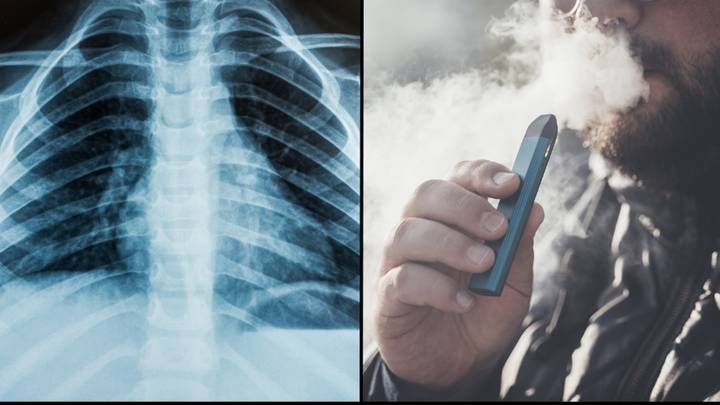 Warning issued over new harmful lung illness EVALI caused by vaping