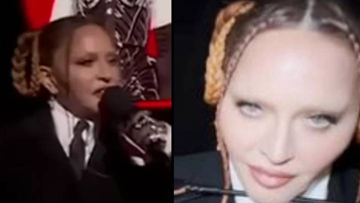 Madonna hits back at trolls who mocked her ‘new face’ at the Grammys