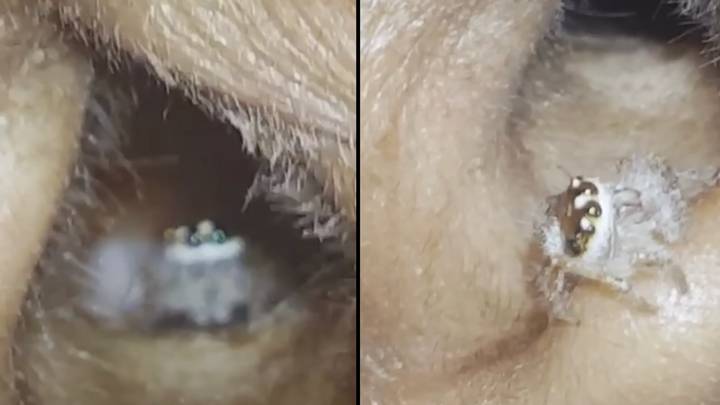 People are horrified over video showing spider crawled up inside person’s ear