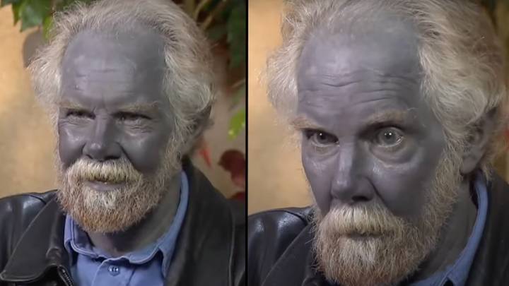 Internet Sensation 'Papa Smurf' Dies; Other Blue People Live On - ABC News