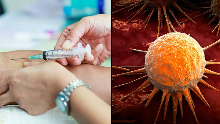 Blood test that spots multiple cancers without clear symptoms hailed as gamechanger