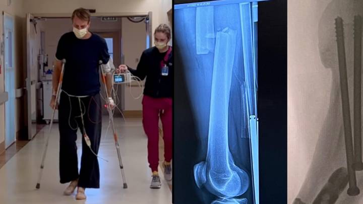Tony Hawk Suffers Horrific Injury And May Never Be The Same Again