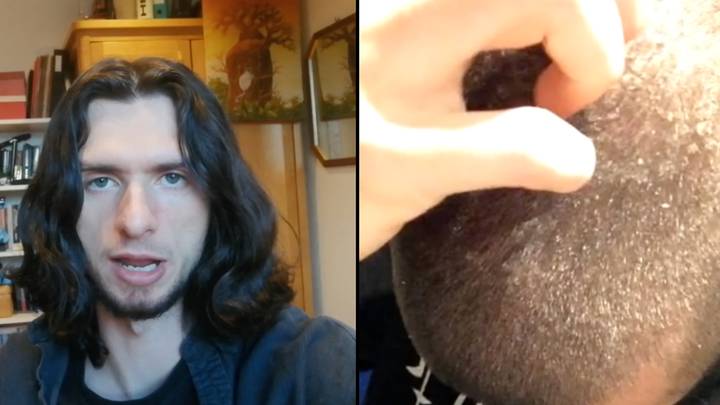 Man who hasn't used shampoo for seven years shows off remarkable results