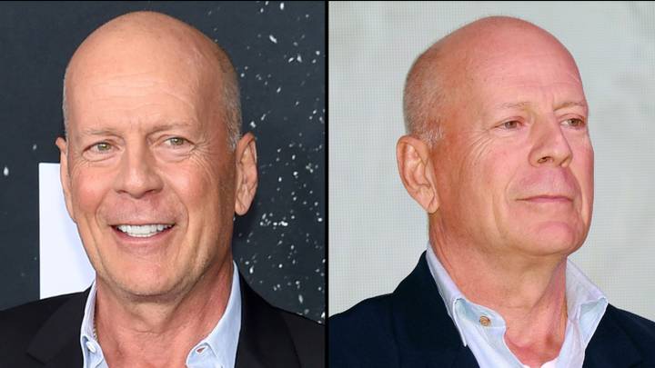 Actor Bruce Willis not totally verbal after dementia diagnosis