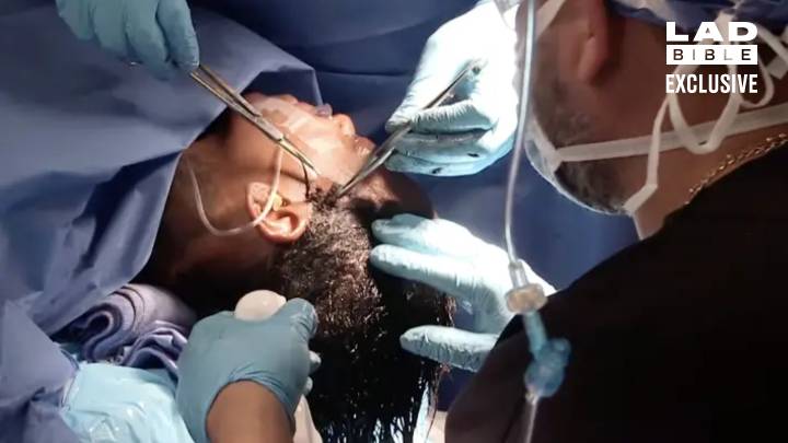 Doctor Reveals How He Removed Gorilla Glue From Woman’s Hair