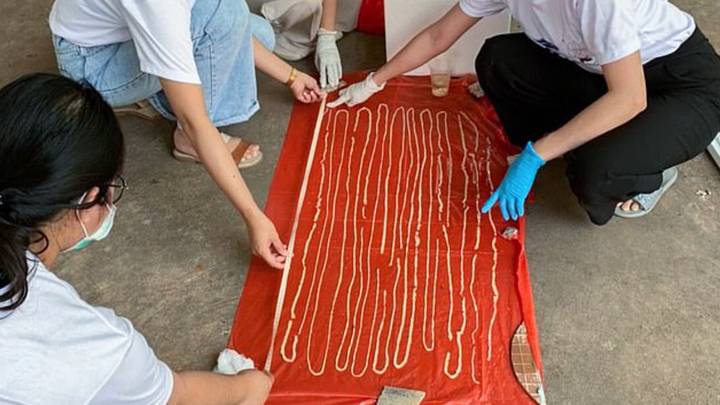 Man Complaining Of 'Extreme' Farts Gets 18 Metre Long Tapeworm Removed From Bum