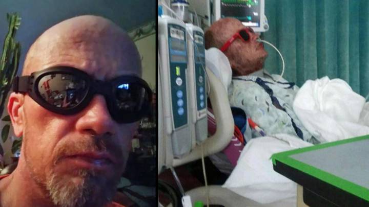 Man Left Looking Like A 'Zombie' After Severe Reaction To Antibiotics