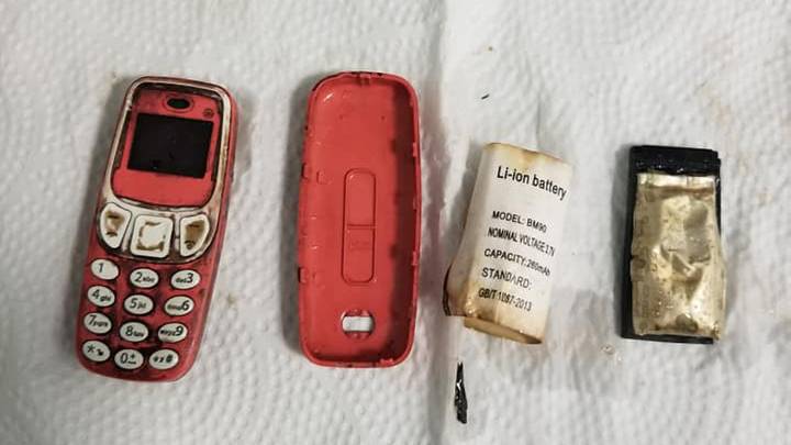 Man Somehow Swallows Nokia 'Brick' Phone