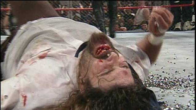 What Are Some Of The Worst Real-Life WWE Wrestling Injuries?