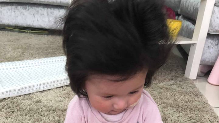Britain's 'Hairiest Baby' Needs Blow Dry Every Night At Just Four Months