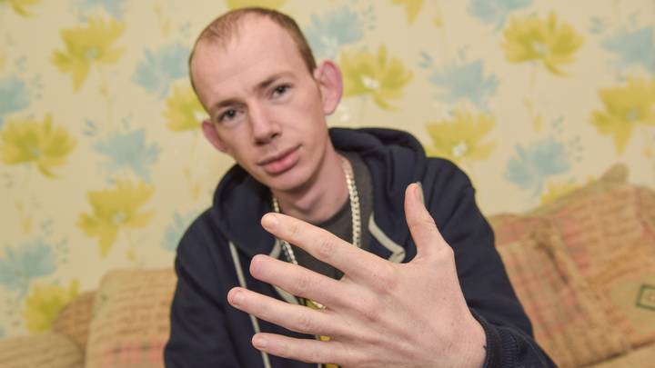 Drunk Man Wakes Up With Top Of Finger Missing After Night Out