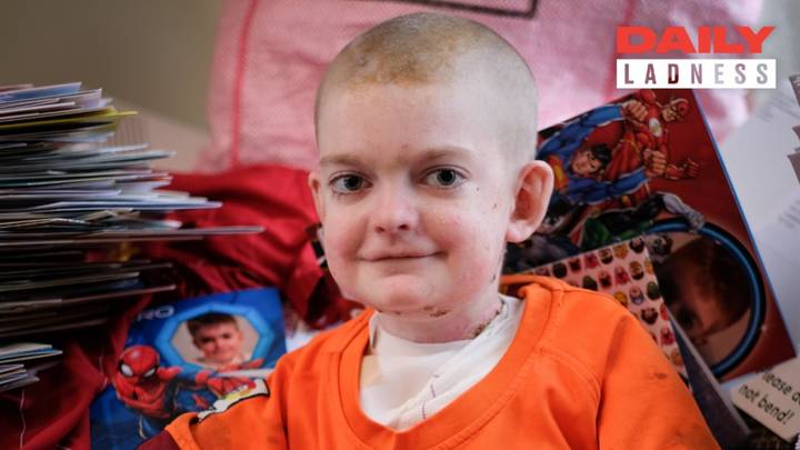 Schoolboy With Agonising Skin Condition Receives More Than 10,000 Birthday Cards 