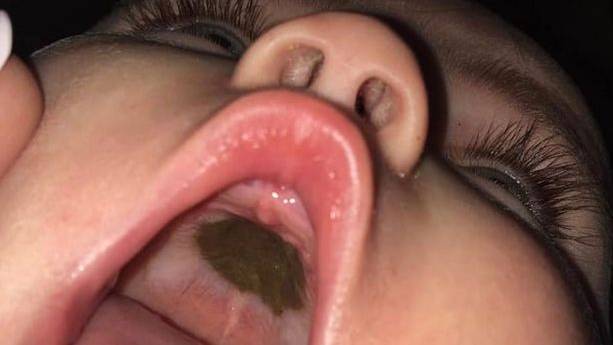 Mum Goes From Worried To Mortified After Finding Mysterious Mark In Baby's Mouth