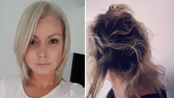 Woman Claiming £16,000 Damages After Bleach Causes Hair To Fall Out