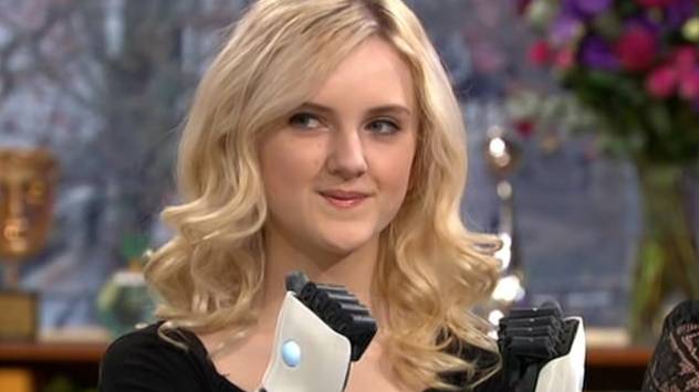 Teen With Bionic Hands Proves She's An Expert At Applying Her Glam