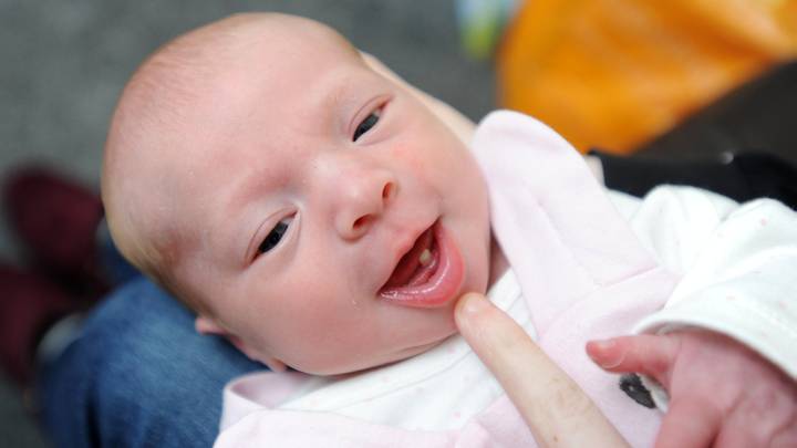 Mum Stunned As Her Baby Is Born With A Tooth