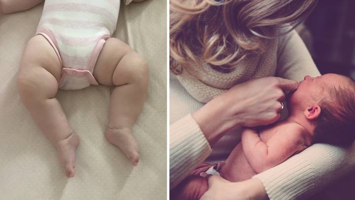 Mum Airs Concerns Over Whether Her Baby Girl's Legs Are 'Too Fat'