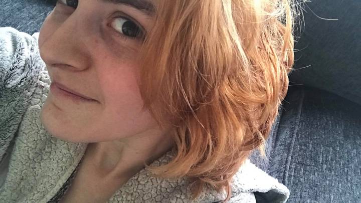 Woman's Hair Turns Orange In Home Dye Fail 