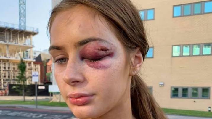 Girl Punched Unconscious Because She Told A Guy She Wasn’t Interested In Him