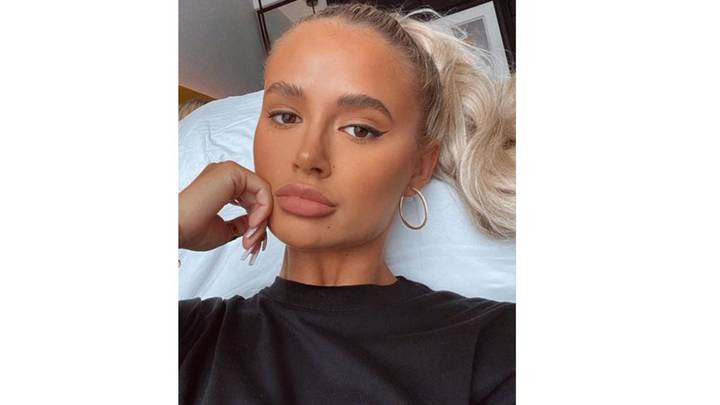 Molly-Mae Hague Reveals She's Undergoing Surgery Following Mole Removal