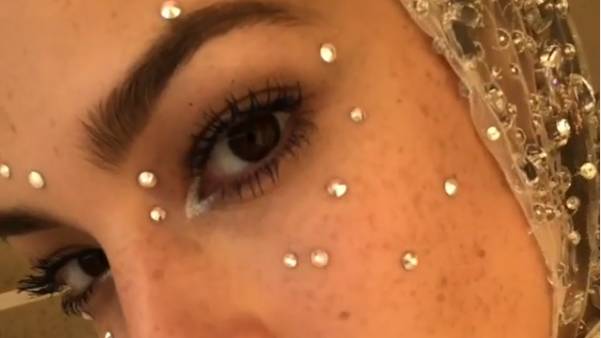 Crystal Freckles Are Here - And We're Kind Of Into It