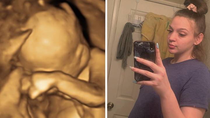 Woman Shares Tragic Reality Of Carrying Baby Who Is ‘Incompatible With Life’ After Roe Vs Wade Reversal
