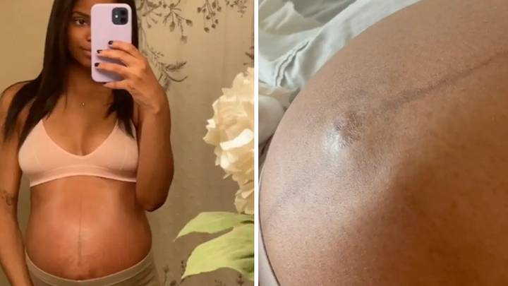 People Amazed As Pregnant Mum Captures Baby's 'Foot' Moving