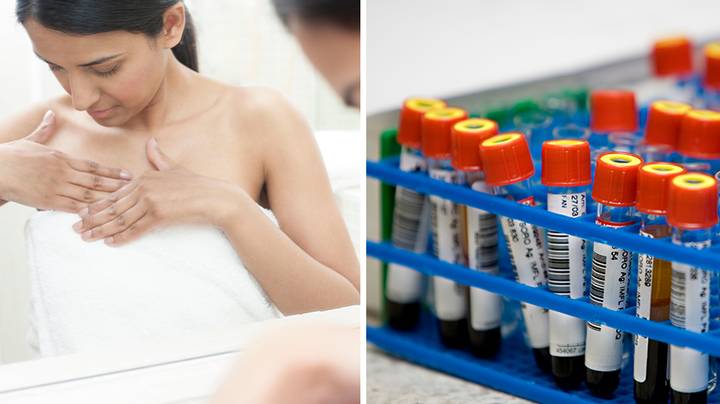 Simple Blood Test Could Detect Breast Cancer In Scientific Breakthrough