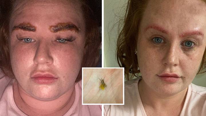 Woman Says Her Eyebrows 'Fell Off' Her Face After Tint Goes Horribly Wrong