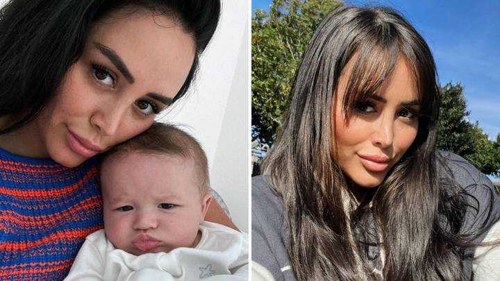 Marnie Simpson says son has 'severe' skull condition