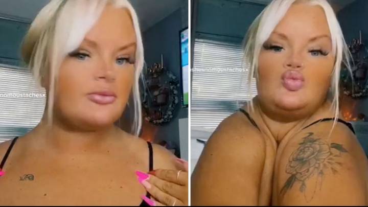 Woman with one-in-a-million condition born without collarbones
