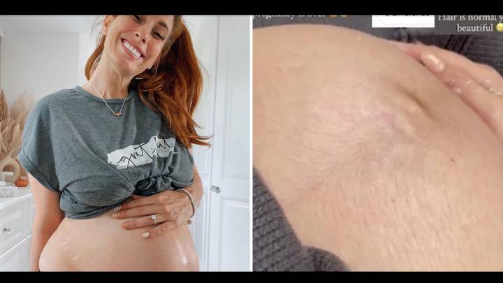 Stacey Solomon Praised As She Hits Back At Troll For Comments On Her Hairy Baby Bump