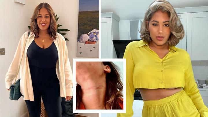 Malin Andersson Praised For Raising Awareness Of Domestic Abuse With Picture Of Scars