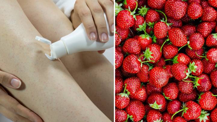 Woman Sparks Debate On Strawberry Legs
