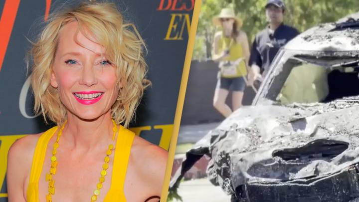 Anne Heche is in a coma following her car crash