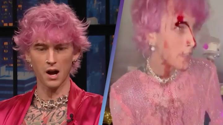 Machine Gun Kelly Explains Why He Smashed A Glass On His Face