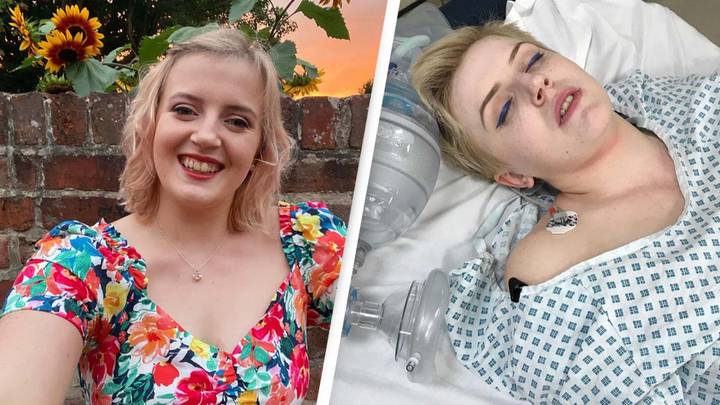 Woman Allergic To Strong Emotions Nearly Died From Laughing Too Much